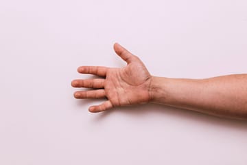 carpal tunnel syndrome picture